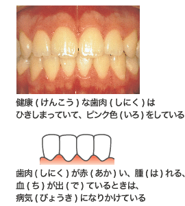 しれつこうごうチェックポイント