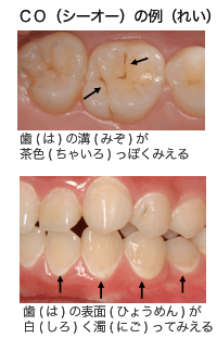 しれつこうごうチェックポイント