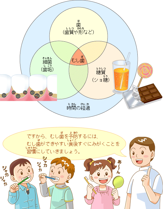 食後すぐ歯をみがこう