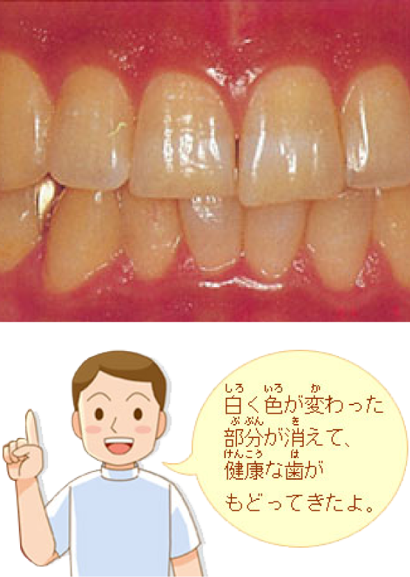 イメ-ジ